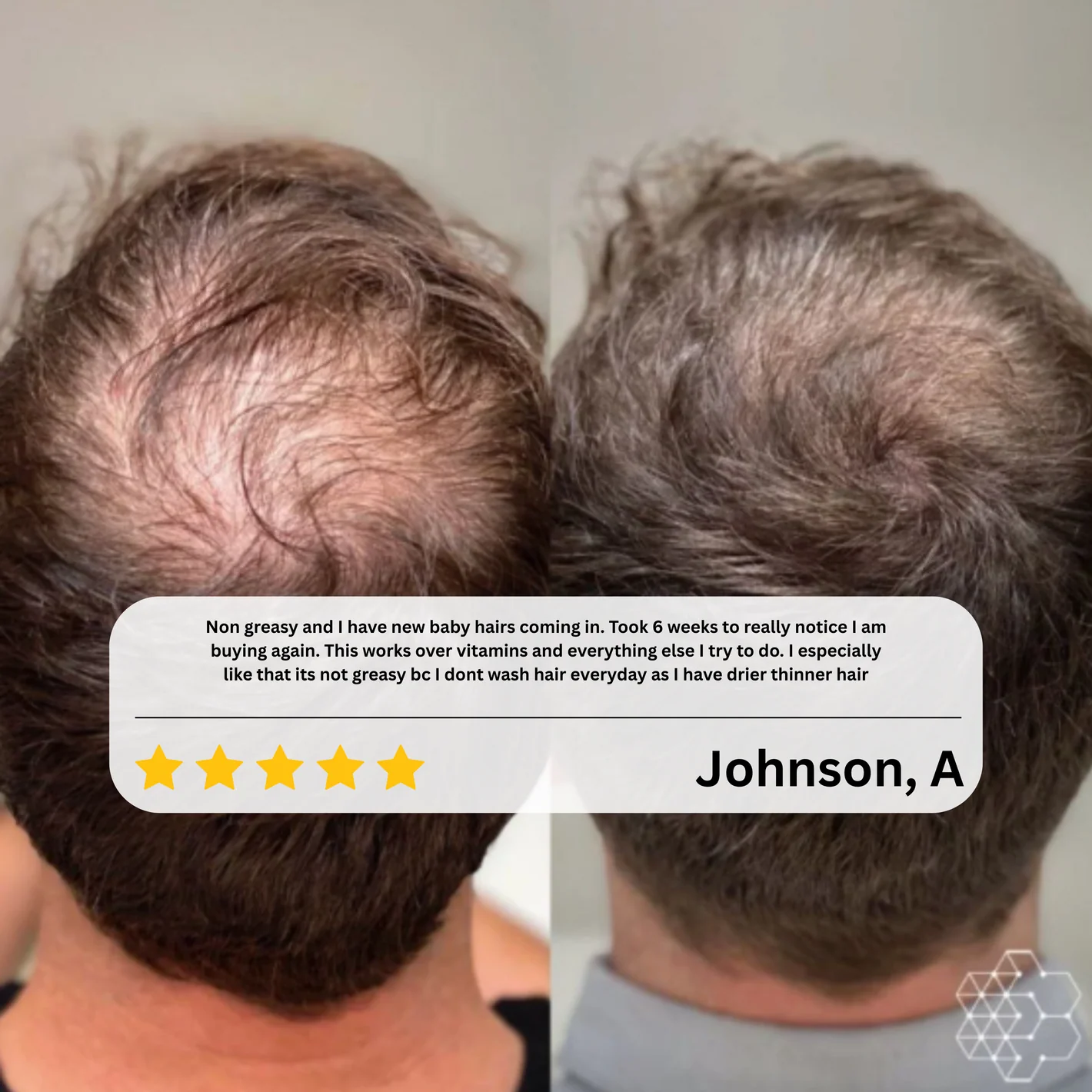 Eloura HairRevive™ Roll on System