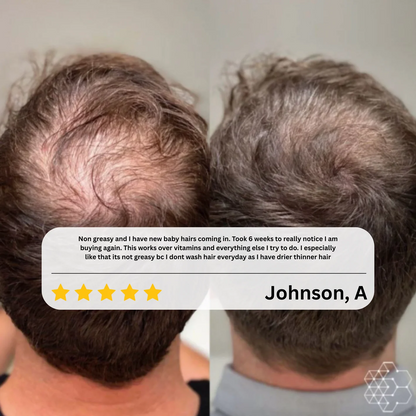 Eloura HairRevive™ Roll on System