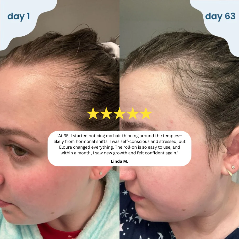 Eloura HairRevive™ Roll on System